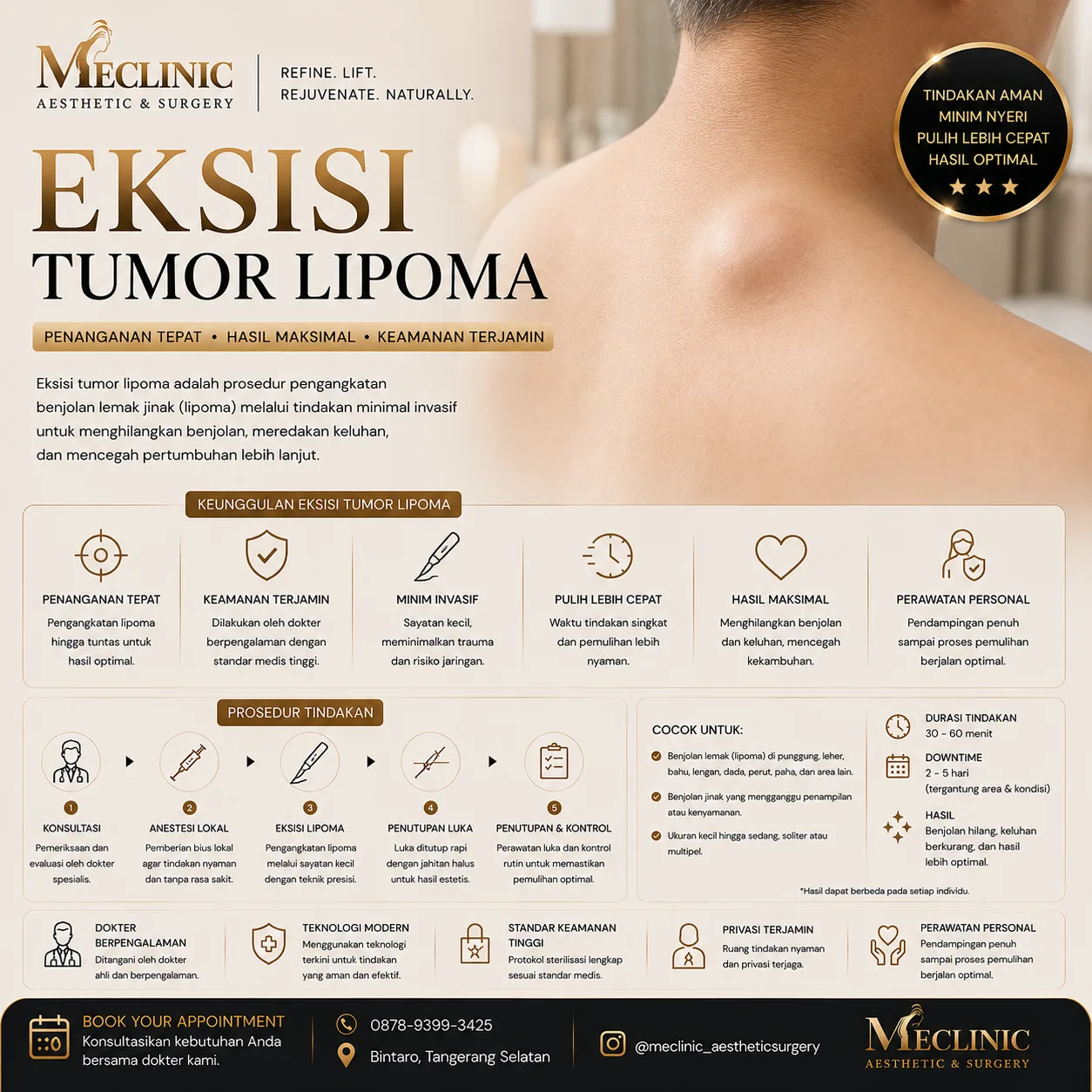 Eksisi Tumor Lipoma (Besar)