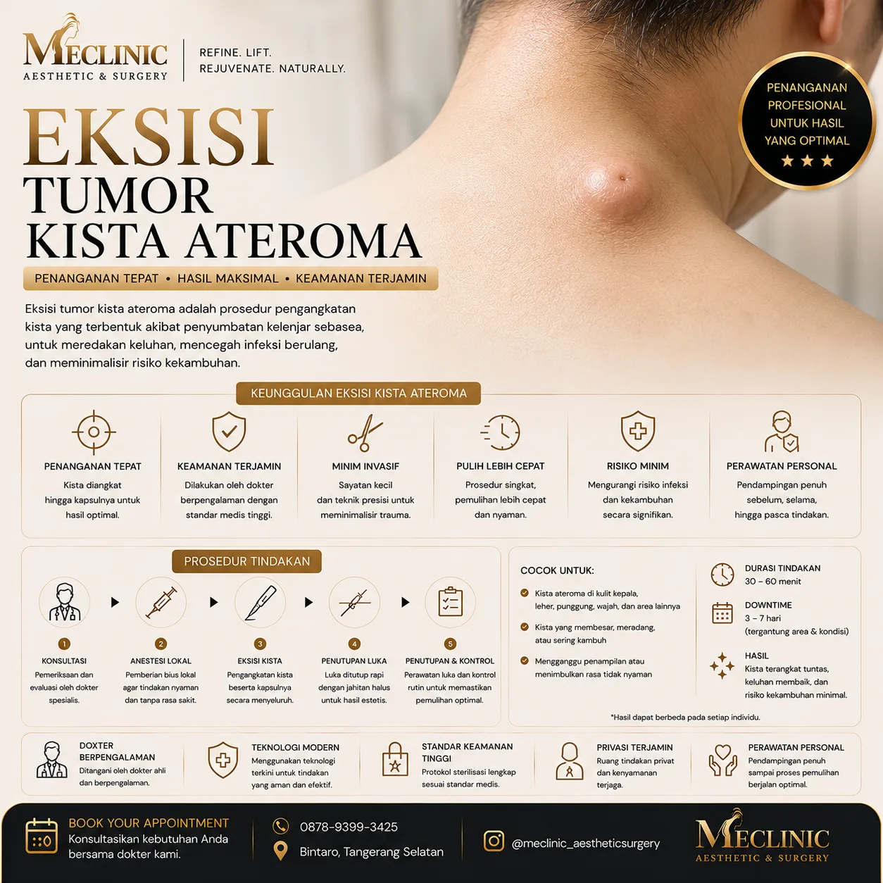 Eksisi Tumor Kista Ateroma (Kecil)